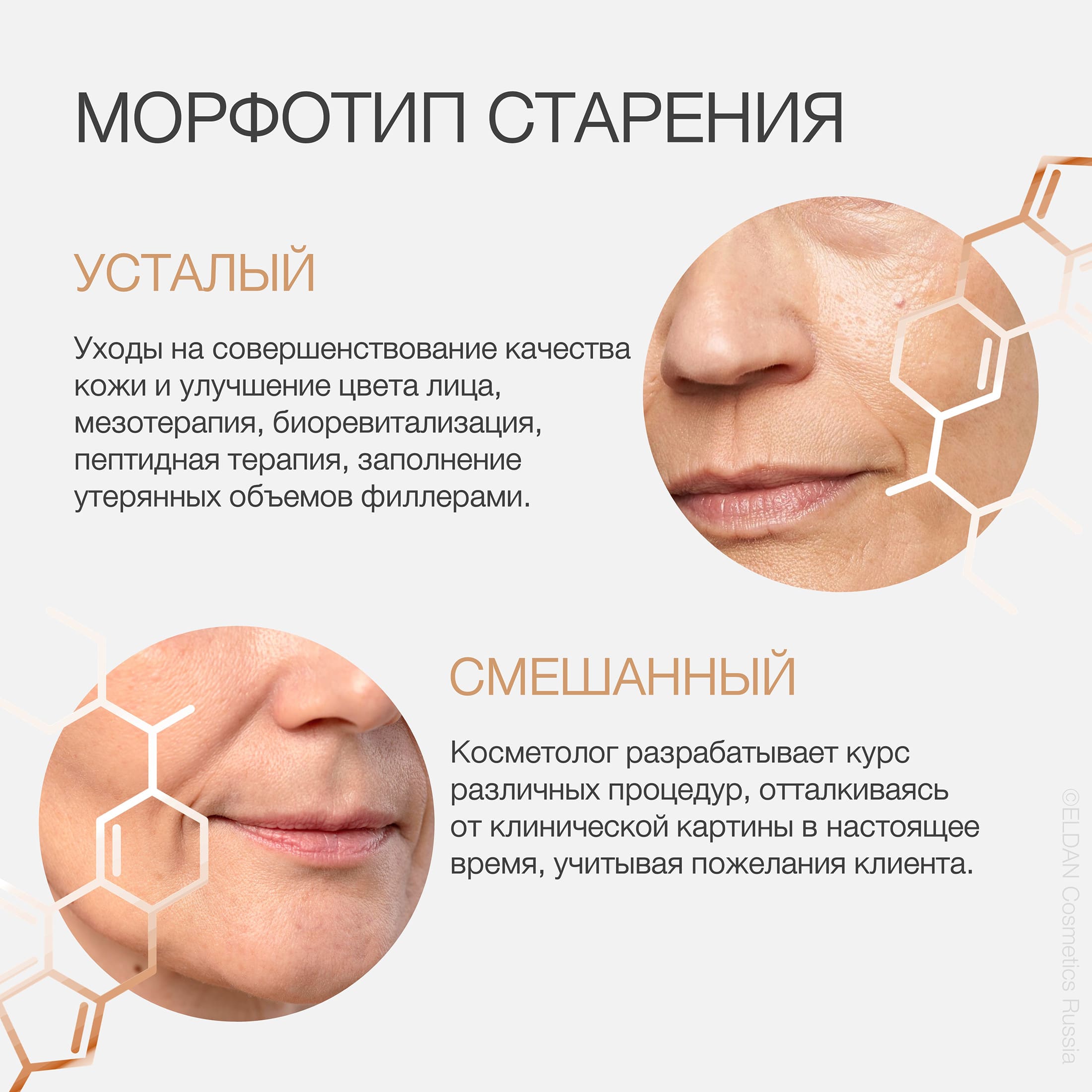 Пост генетика и кожа 4.jpg Пост генетика и кожа 4.jpg